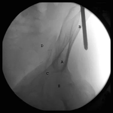 General Orthopedics 2026 Practice Questions: Set 15 (Solved) - Figure 97