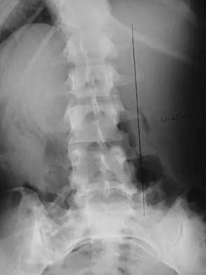 General Orthopedics Board Review 2026: High-Yield MCQs (Set 16) - Figure 101