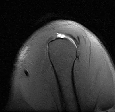 General Orthopedics Board Review 2026: High-Yield MCQs (Set 16) - Figure 109