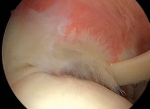 General Orthopedics Board Review 2026: High-Yield MCQs (Set 16) - Figure 110