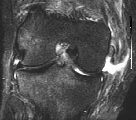 General Orthopedics Board Review 2026: High-Yield MCQs (Set 16) - Figure 112
