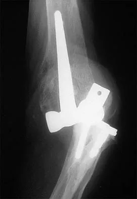 General Orthopedics Board Review 2026: High-Yield MCQs (Set 16) - Figure 117