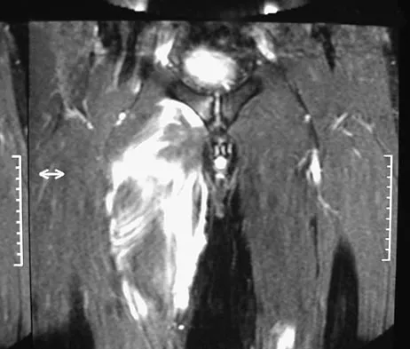 General Orthopedics Board Review 2026: High-Yield MCQs (Set 16) - Figure 121