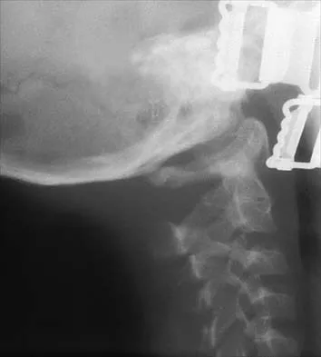 General Orthopedics Board Review 2026: High-Yield MCQs (Set 16) - Figure 126