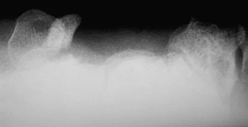 General Orthopedics Board Review 2026: High-Yield MCQs (Set 16) - Figure 128