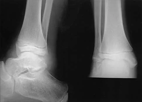 General Orthopedics Board Review 2026: High-Yield MCQs (Set 16) - Figure 16