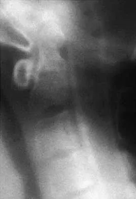 General Orthopedics Board Review 2026: High-Yield MCQs (Set 16) - Figure 18