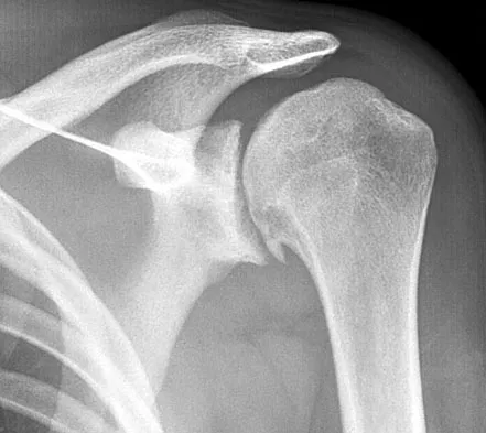 General Orthopedics Board Review 2026: High-Yield MCQs (Set 16) - Figure 2