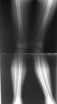 General Orthopedics Board Review 2026: High-Yield MCQs (Set 16) - Figure 21