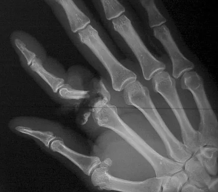 General Orthopedics Board Review 2026: High-Yield MCQs (Set 16) - Figure 23