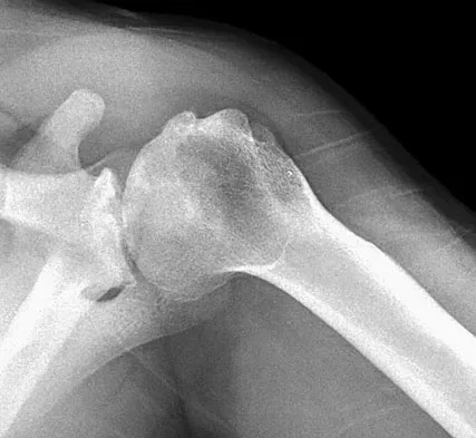 General Orthopedics Board Review 2026: High-Yield MCQs (Set 16) - Figure 3