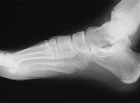 General Orthopedics Board Review 2026: High-Yield MCQs (Set 16) - Figure 31