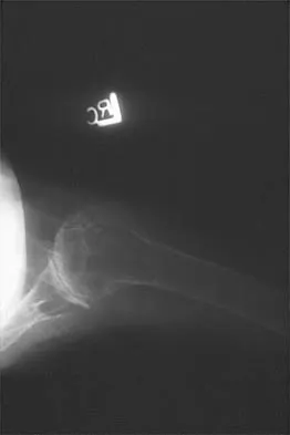 General Orthopedics Board Review 2026: High-Yield MCQs (Set 16) - Figure 33