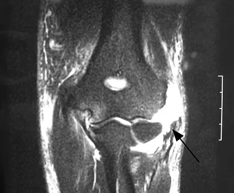 General Orthopedics Board Review 2026: High-Yield MCQs (Set 16) - Figure 35