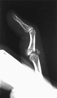 General Orthopedics Board Review 2026: High-Yield MCQs (Set 16) - Figure 37