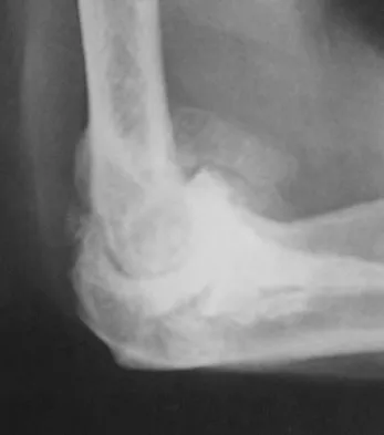 General Orthopedics Board Review 2026: High-Yield MCQs (Set 16) - Figure 43