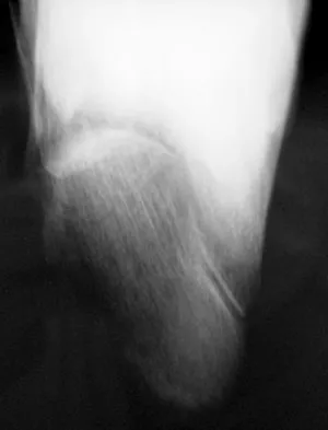 General Orthopedics Board Review 2026: High-Yield MCQs (Set 16) - Figure 46