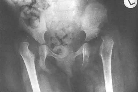 General Orthopedics Board Review 2026: High-Yield MCQs (Set 16) - Figure 50
