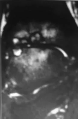 General Orthopedics Board Review 2026: High-Yield MCQs (Set 16) - Figure 57