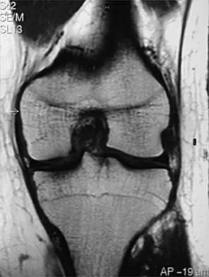 General Orthopedics Board Review 2026: High-Yield MCQs (Set 16) - Figure 69