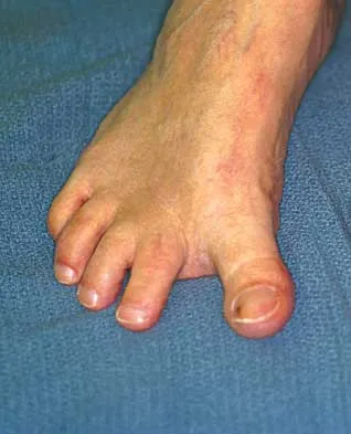 General Orthopedics Board Review 2026: High-Yield MCQs (Set 16) - Figure 72