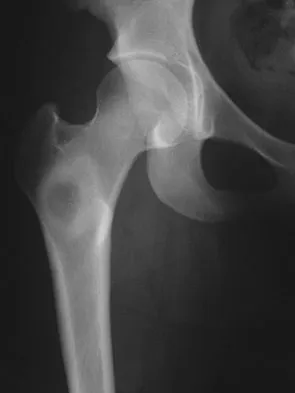 General Orthopedics Board Review 2026: High-Yield MCQs (Set 16) - Figure 73