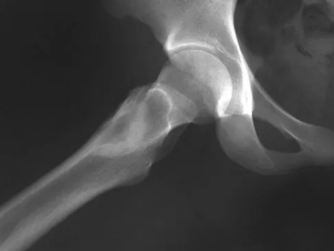 General Orthopedics Board Review 2026: High-Yield MCQs (Set 16) - Figure 74