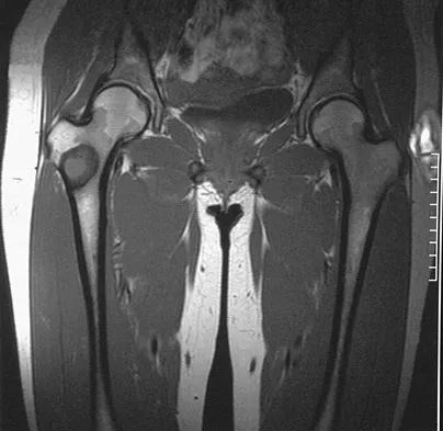 General Orthopedics Board Review 2026: High-Yield MCQs (Set 16) - Figure 76