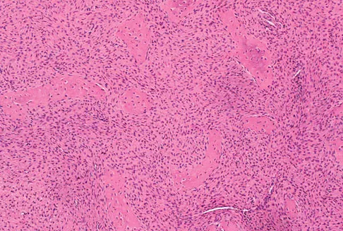 General Orthopedics Board Review 2026: High-Yield MCQs (Set 16) - Figure 77