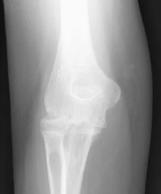 General Orthopedics Board Review 2026: High-Yield MCQs (Set 16) - Figure 83