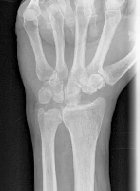 General Orthopedics Board Review 2026: High-Yield MCQs (Set 16) - Figure 89