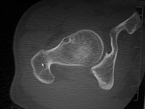 General Orthopedics Board Review 2026: High-Yield MCQs (Set 16) - Figure 96