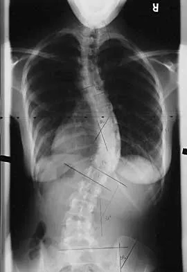 General Orthopedics Board Review 2026: High-Yield MCQs (Set 16) - Figure 97