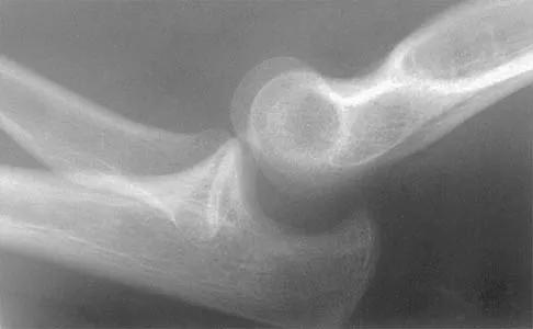 Orthopedics MCQs Set 17: Spine Trauma, Shoulder Arthroscopy & Pediatric Hip | Board Review 2026