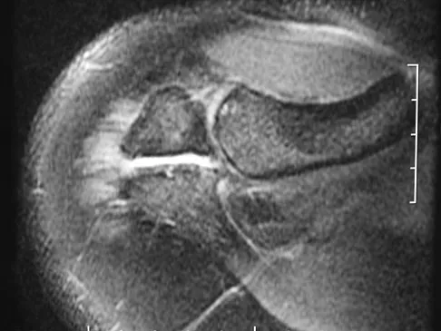General Orthopedics 2026 Practice Questions: Set 17 (Solved) - Figure 12