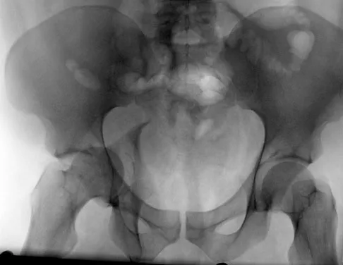 General Orthopedics 2026 Practice Questions: Set 17 (Solved) - Figure 13