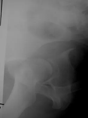 General Orthopedics 2026 Practice Questions: Set 17 (Solved) - Figure 15