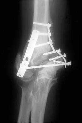 General Orthopedics 2026 Practice Questions: Set 17 (Solved) - Figure 21