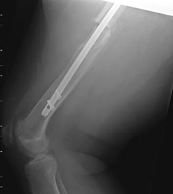 General Orthopedics 2026 Practice Questions: Set 17 (Solved) - Figure 23