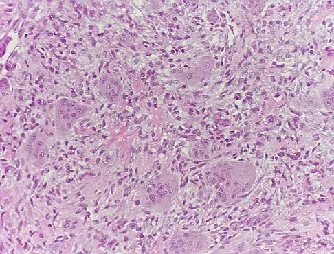 General Orthopedics 2026 Practice Questions: Set 17 (Solved) - Figure 28