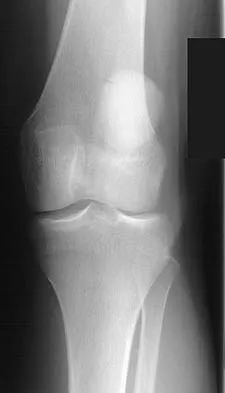 General Orthopedics 2026 Practice Questions: Set 17 (Solved) - Figure 3