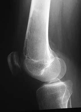 General Orthopedics 2026 Practice Questions: Set 17 (Solved) - Figure 31