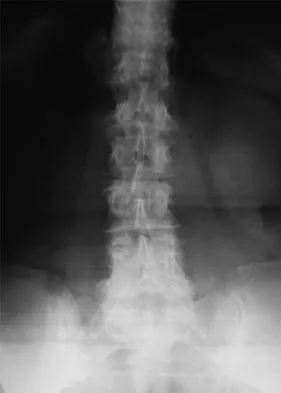 General Orthopedics 2026 Practice Questions: Set 17 (Solved) - Figure 33