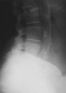 General Orthopedics 2026 Practice Questions: Set 17 (Solved) - Figure 34