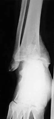 General Orthopedics 2026 Practice Questions: Set 17 (Solved) - Figure 37