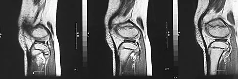 General Orthopedics 2026 Practice Questions: Set 17 (Solved) - Figure 44