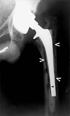 General Orthopedics 2026 Practice Questions: Set 17 (Solved) - Figure 45