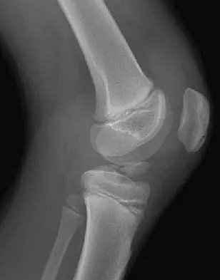 General Orthopedics 2026 Practice Questions: Set 17 (Solved) - Figure 46