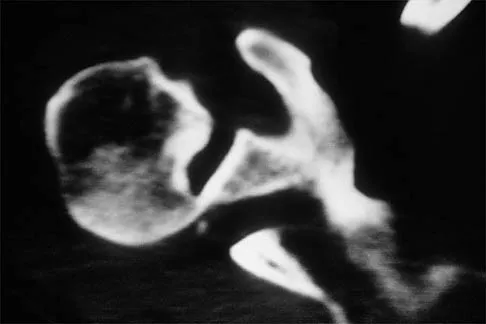 General Orthopedics 2026 Practice Questions: Set 17 (Solved) - Figure 49