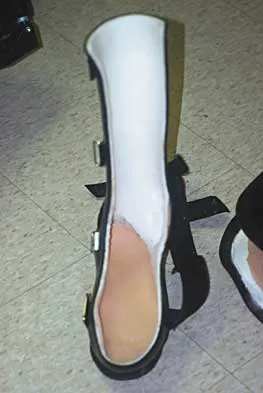 General Orthopedics 2026 Practice Questions: Set 17 (Solved) - Figure 55